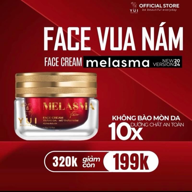 KEM VUA NÁM MẠNH 30G|| melasma face cream làm đẹp da Phiên Bản Mới