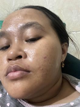 Product Review of Finally Found You! PAKET Brightening & Hydrating from C**y A**a 2