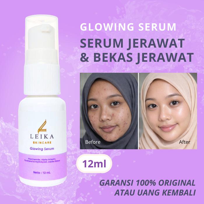 Gambar AMPUH Serum Bopeng dan Bekas Jerawat Leika Skincare Serum Mengatasi Jerawat Serum Jerawat di Wajah Perawatan Muka Bopeng Bruntusan dari Pure Life Beauty Kota Cirebon Tokopedia