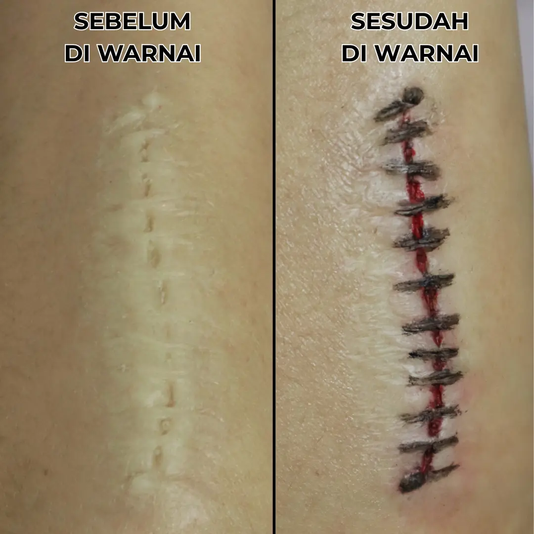 [PRODUK LOKAL] SILICONE PROSTHETIC KELOID JAHITAN | LUKA JAHIT | STITCH | STITCHED WOUND | PROSTETIK BEKAS JAHIT | SFX HALLOWEEN | SILICONE SFX | MAKEUP SFX | COSPLAY | COSPLAYER COSTUME | KOSTUM COSPLAYER | MEDICAL PROSTHETIC | PROSTETIK KESEHATAN