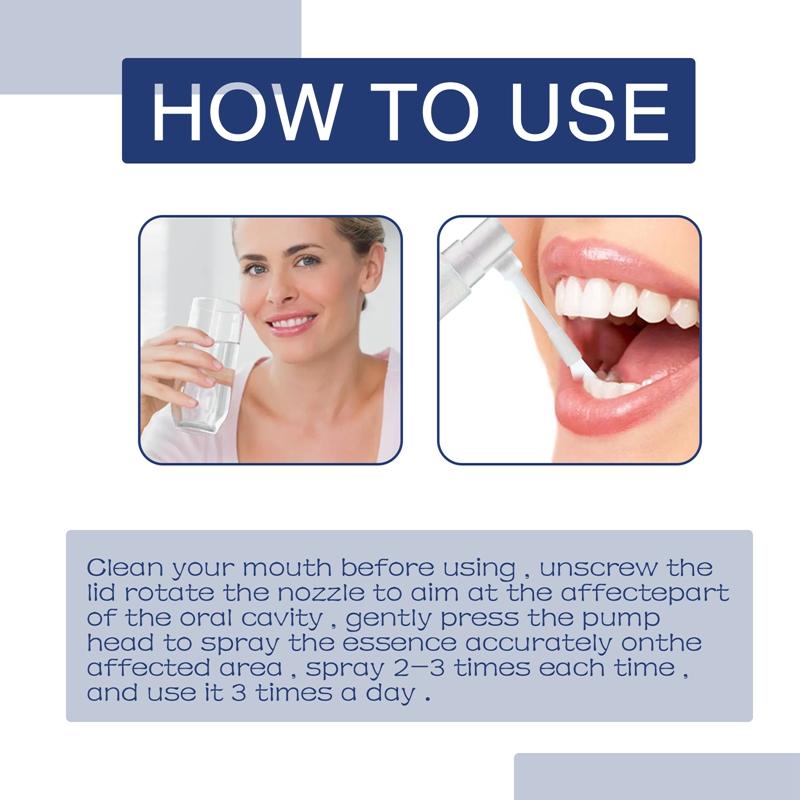 Toothache Spray 20ml Tooth Pains Relief Treatments 5 pcs Toothache Cures Teeth Decay Remover Periodontitis Cleaner Angelica Dahurica berbilang pek tidak mengandungi kedua-duanya 4