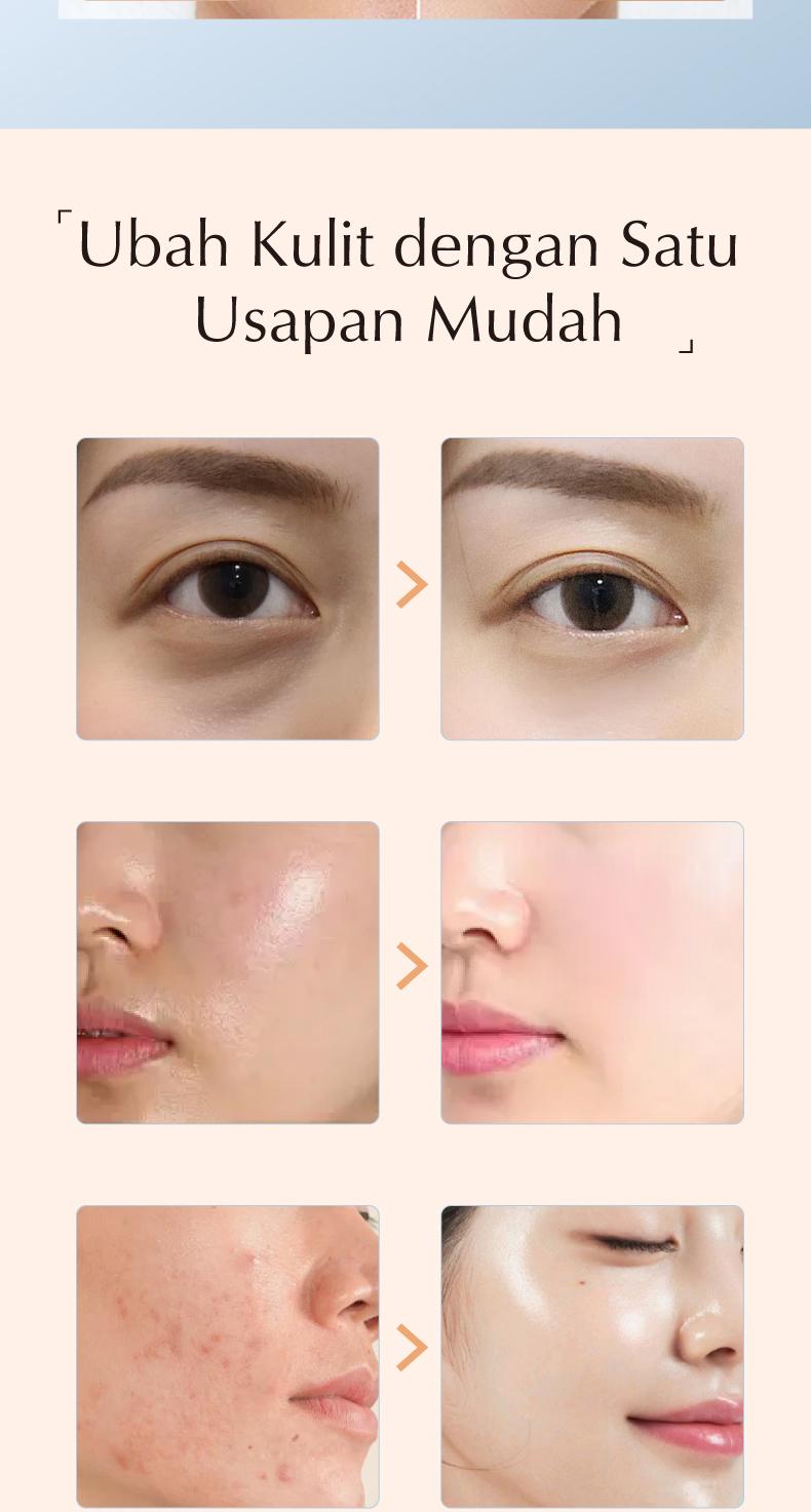 UKU 6-in-1 Retinol Cream 【BPOM Certified】 - Niacinamide + Pro-Xylane + Ceramide NP, brightens skin tone, conceals imperfections, multi-effect makeup primer.