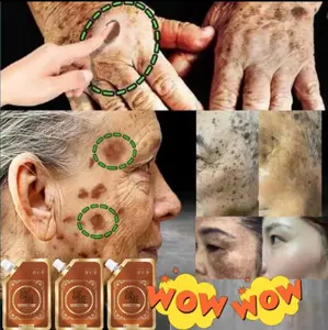 MEETFACE Masker Wajah Menghilangkan Bintik-Bintik Topeng Koyak Anti Penuaan & Kedut Kolagen 100% Penyerapan Melanin Mencerahkan & Mengencangkan Kulit Facial Mask