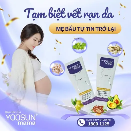 Kem bôi da Yoosun Mama hỗ trợ làm mờ vết rạn - Tuýp 100g 1