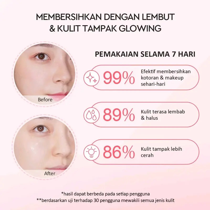 Glad2Glow Milk Amino Acid Gentle Cleanser Face Wash 80ml | Sabun Cuci Muka Pembersih Wajah Facial Cleanser Face Wash Foam Sabun Muka Acne Cleanser Micellar Cleansing g2g cleansermilk untuk chicken skin 3