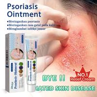 Gambar obat gatal gatal 20g salep gatal eksim paling ampuh psoriasis cream salep jamur selangkangan wanita selangkangan hitam dan gatal salep panu ampuh cepat hilang obat kadas kurap - 1 batang (20g) dari KRVELLA Kab. Bogor 5 Tokopedia