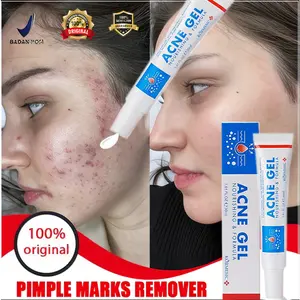 obat penghilang jerawat 20g salep jerawat ampuh dan bekasnya penghilang luka koreng jerawat paling ampuh removal acne cream untuk pria dan wanita