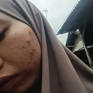 [BEST PRICE] YOU Acne Shield Light Sunscreen SPF40+ PA++++ Tabir Surya Oil Control untuk Kulit Berjerawat Sensitive Acne Skin Friendly Ringan UVA UVB Blue Light Skincare Sunblock Tidak Berminyak All Skin Type