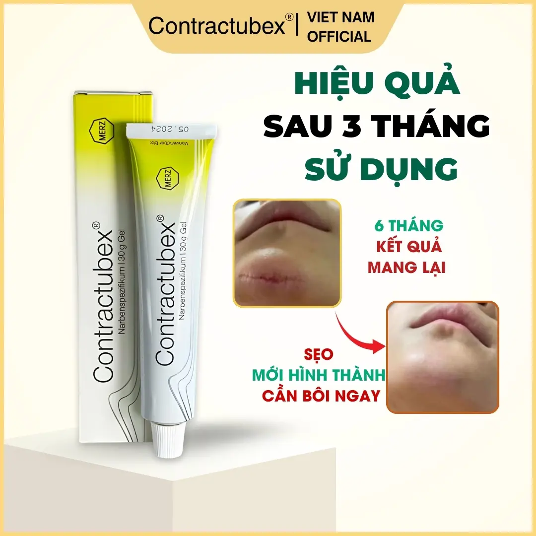 Kem làm mờ sẹo thâm sẹo lồi Contractubex 30g Đức  hỗ trợ làm mềm phẳng sẹo, giảm rạn da và ngăn sẹo mới hình thành - Skincare Peel Da