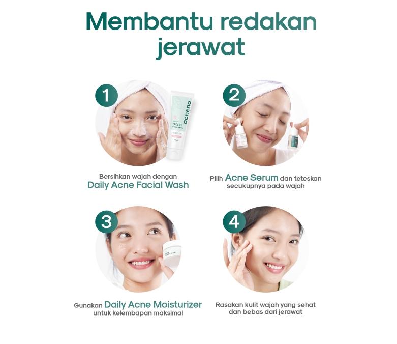 Product Introduction of Daily Acne Moisturizer - Acneno isi 50gr | Memperbaiki Skin Barrier Kulit | Membantu Wajah Lebih Terhidrasi Kandungan Panthenol Aman Untuk Bumil & Busui | BPOM Original 2