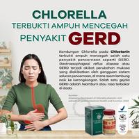 Gambar CHLOSTANIN Kesehatan Pencernaan Mengatasi Alergi dari Jual Chlostanin Kota Administrasi Jakarta Barat 3 Tokopedia