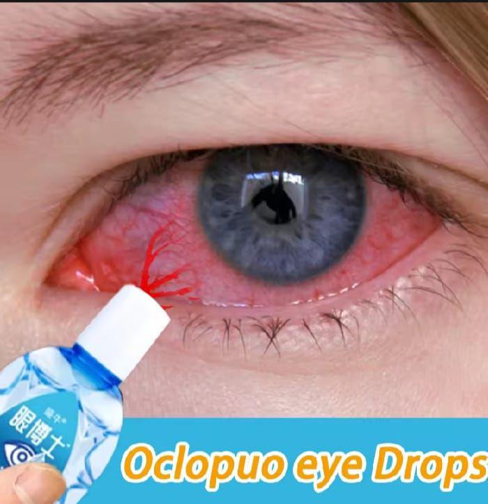 YEHUANGSU OBAT TETES MATA NO 1 JEPANG / TETES MATA JEPANG OBAT TETES MATA BERLEMAK KEKUNINGAN PTERIGIUM GLUKOMA MATA KATARAK