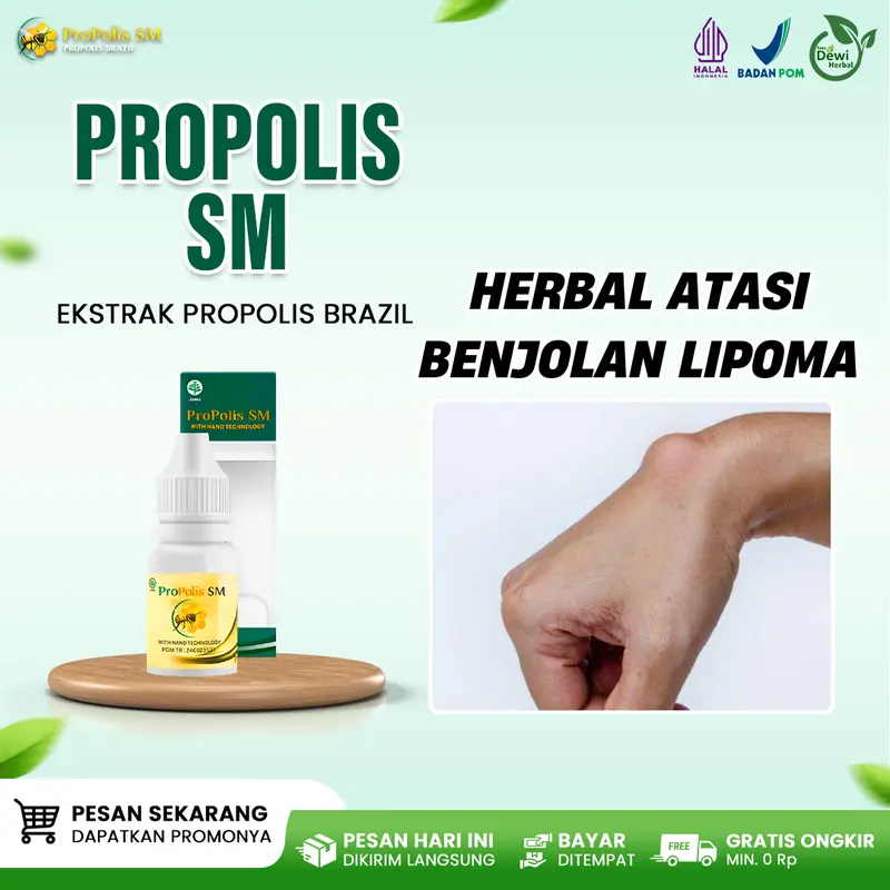 Propolis SM Herbal Benjolan Uci Uci di Ketiak, Kepala, Belakang Telinga, dan Tangan - Isi 6ml 0