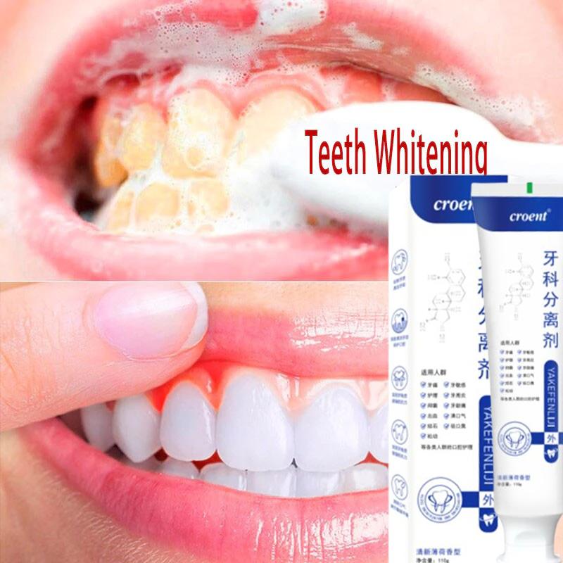 110gr Pasta Gigi Untuk Gigi Yang Goyang  Pasta Gigi Biofarmasi Yang Memperbaiki Masalah Gigi Dan Memperbaiki Gigi Berlubang, Memperbaiki Gusi Rusak Dengan Cepat, Dan Memperbaiki Gigi 110gr