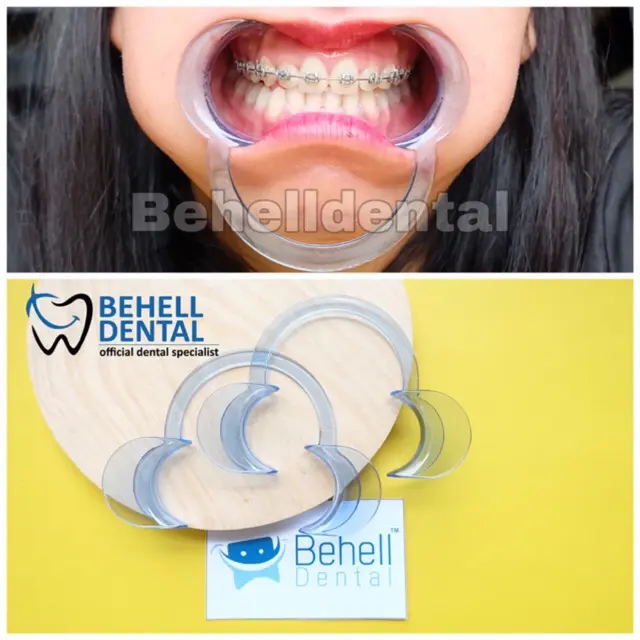 ORI ALAT PEMBUKA MULUT BENTUK C INTRAORAL BIRU CHEEK RETRACTOR PENYANGGA RAHANG GIGI BEHEL MOUTH GAG // Bisa Untuk Anak Dewasa // Elastis Size M L S // Mouth Gate // Mouthgate Original Gusi Cairan 0