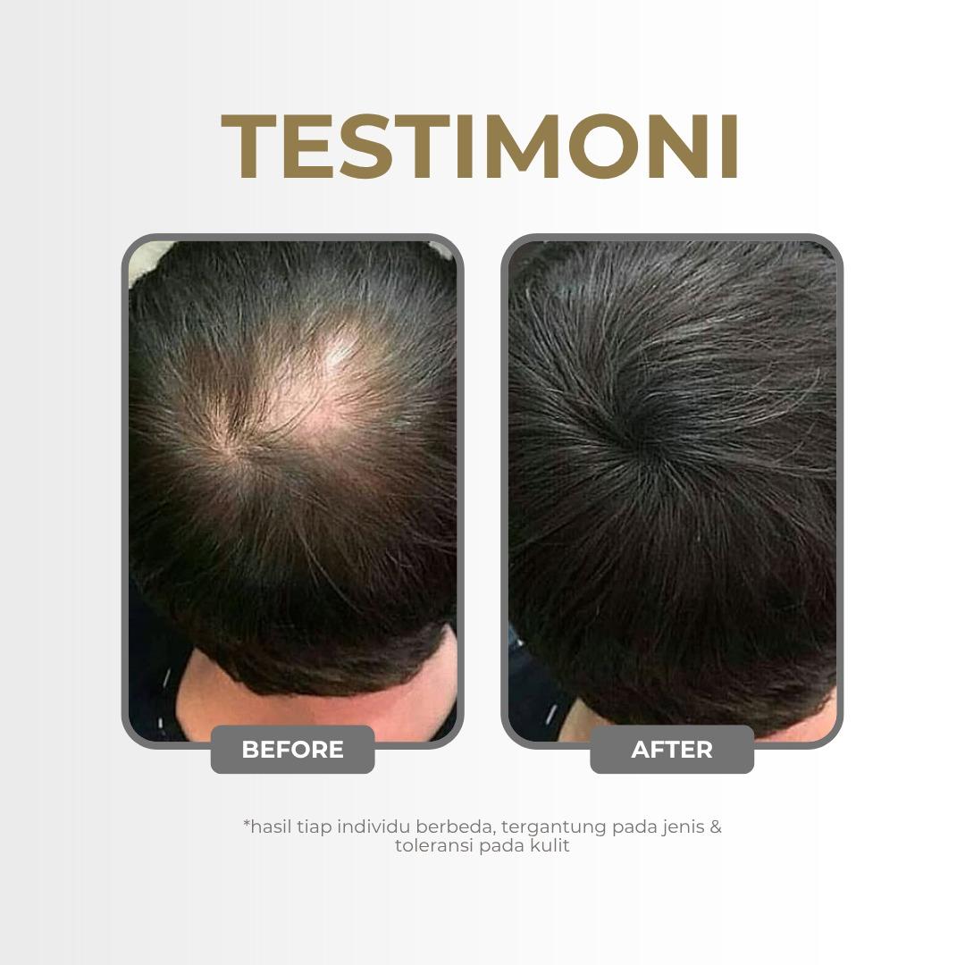 MINYAK KEMIRI BAKAR 100% KEMIRI ASLI - Nutrisi Alami untuk Menguatkan Menebalkan dan Mengatasi Rambut Rontok Aman untuk Balita dan Semua Usia 30ML