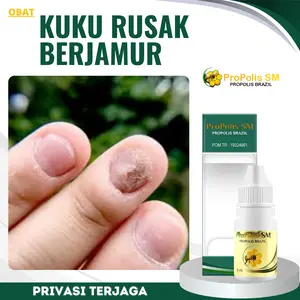 Tetes Kuku Rusak Berjamur, Penghilang Jamur Pada Kuku, Tetes Kuku Cantengan, Salep Penghilang Kuku Berjamur - Propolis Sm