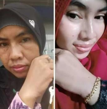 Product Review of D Vine Collagen Isi 20 Permen Collagen Pemutih Kulit Original Korea from S**i 0