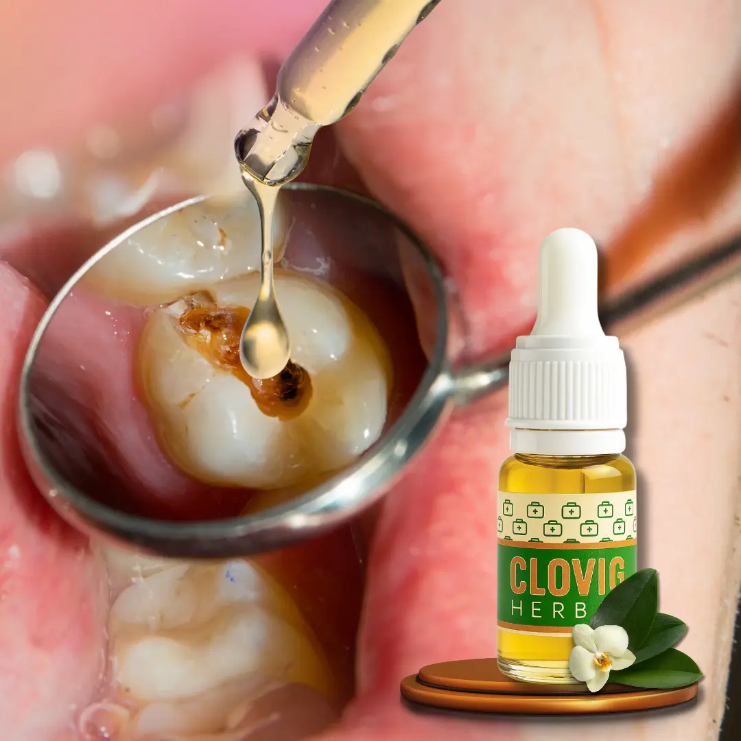 Clovig Obat Sakit Gigi Gusi Bengkak Ampuh Clovig Herbal Solusi Alami Untuk Kesehatan Mulut