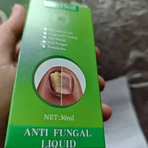 SooHeal Cairan Anti Jamur Kuku 30ml | Perawatan Kuku Rusak, Kuku Kuning, Kuku Rapuh & Retak | Cepat Meresap, Praktis Digunakan