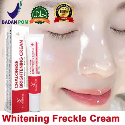CHALONESE CREAM WHITENING & FRECKLE CREAM FLEK HITAM DAN PENCERAH WAJAH BPOM Pelembab Muka Mencerahkan 0