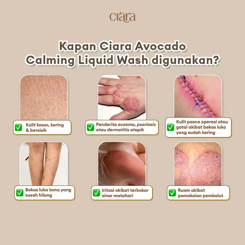 Ciara Avocado Calming Liquid Wash X Chamomile Calming Cream Melembutkan Kulit dan Kulit Gatal 2