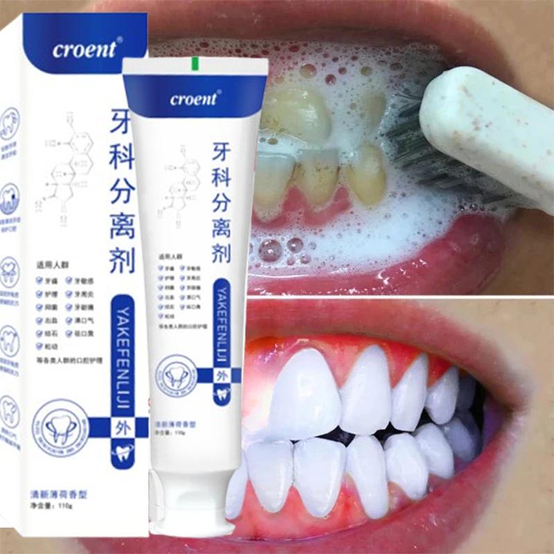 110gr Pasta Gigi Untuk Gigi Yang Goyang  Pasta Gigi Biofarmasi Yang Memperbaiki Masalah Gigi Dan Memperbaiki Gigi Berlubang, Memperbaiki Gusi Rusak Dengan Cepat, Dan Memperbaiki Gigi 110gr