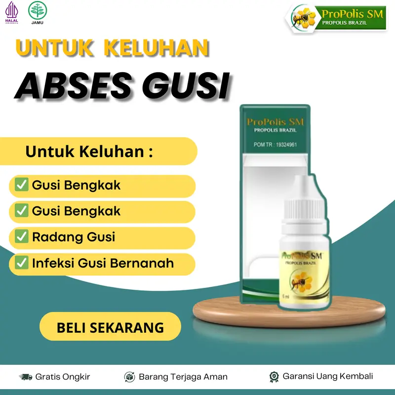 Tetes Propolis SM Untuk Abses Gusi, Sakit Gusi, Gusi Bengkak, Gusi Berdarah, Gusi Bernanah, Benjolan di Gusi, Radang Gusi, Infeksi Gusi 0