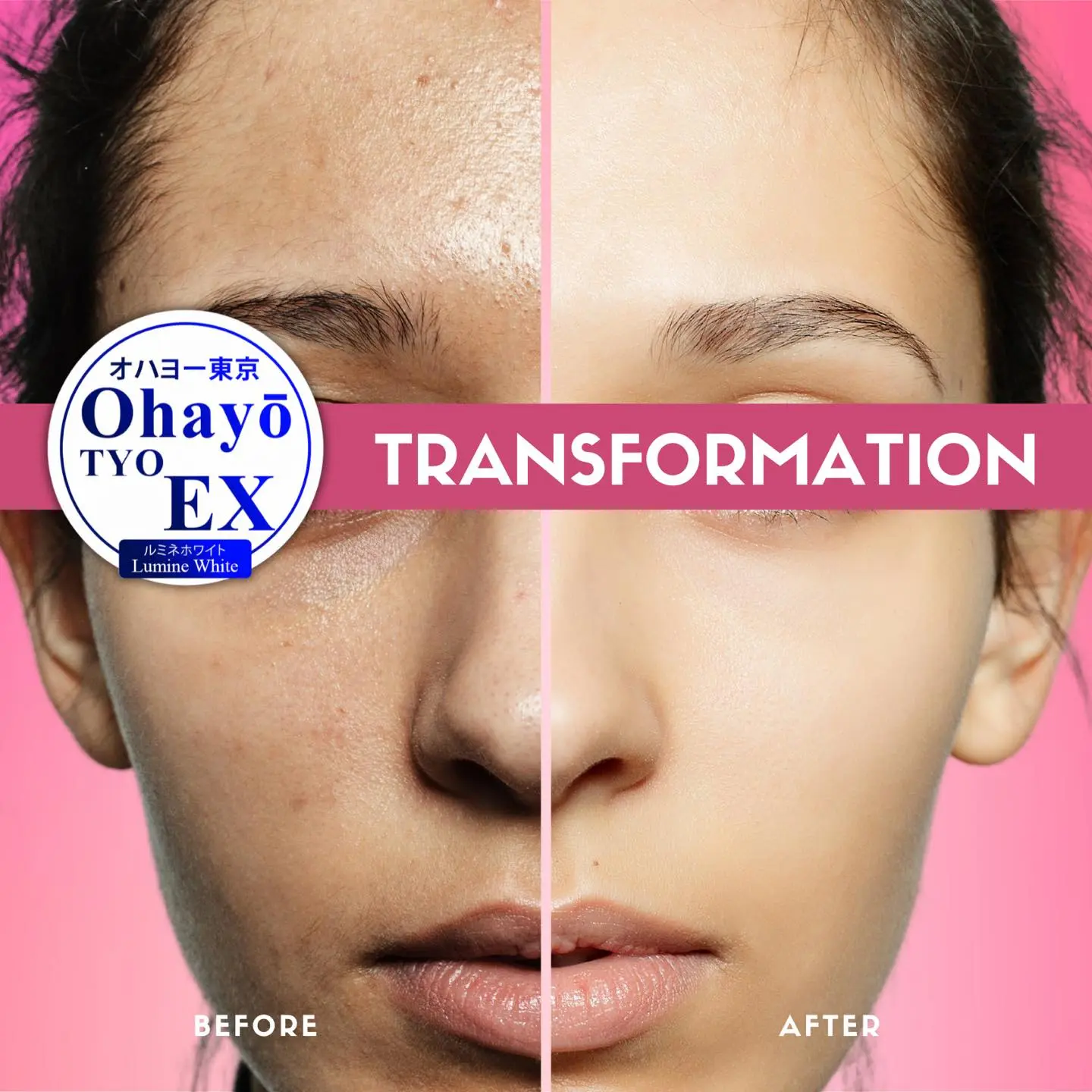 ohayo tokyo glutathione price philippines ✨ Ohayo Tyo EX Lumine White Glutathione – 60s (Japan) ✨, Advanced  Japanese-formulated glutathione supplement to help promote brighter,  clearer skin and support overall beauty from within 🌸🤍, Perfect main image 1