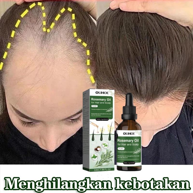 Rosemary hair oil hair tonic penumbuh rambut dengan cepat dan botak tebal serum rambut rontok Hair growth serum Minyak 2