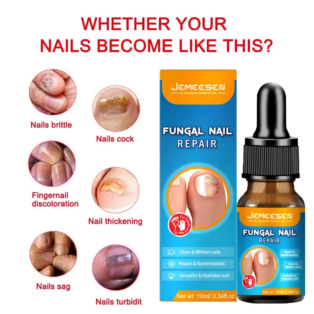 Jemeesen Onychomycosis Nail Repair Solution Inhibits Fungus Growth Promotes Healthy Nails Effective Fungal Relief Formula nail essence