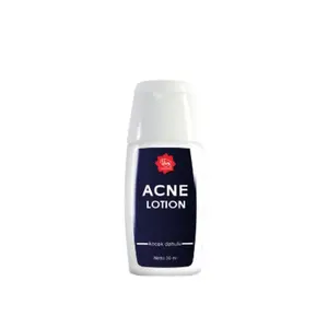 Viva Acne Lotion PM 30 ml