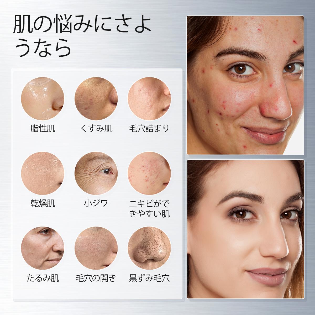 NING DERMOLOGIE シンガポール「Tembusu エッセンス」スキンケアギフト 
