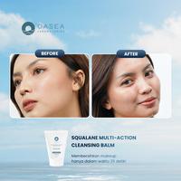Gambar [NFS] Oasea Squalane Multi - Action Cleansing Balm 5g - Pembersih Make Up untuk Semua Jenis Kulit/Kulit Berjerawat/Sensitif dari Oasea Laboratories Kab. Sleman 4 Tokopedia