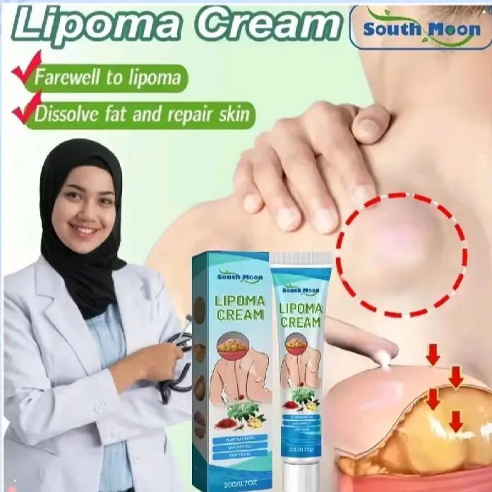 krim penghapus benjolan lemak lipoma Ketiak Selangkangan Memudarkan