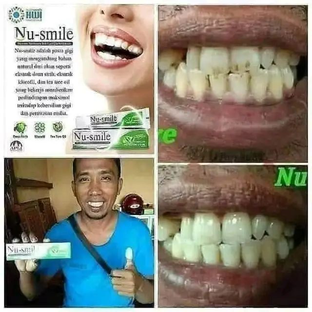 Nu Smile HWI Odol Herbal Rontokan Karang Gigi Perawatan Mulut 2