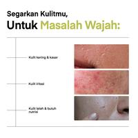 Gambar SKINTERRA Fruit Sheet Mask Vitamin C & Avocado 25g Masker Wajah untuk Mencerahkan Kulit Kusam Kering Melembapkan Intens Dengan Panthenol Allantoin - Avocado, 1 Box dari Skinterra Indonesia Kota Administrasi Jakarta Barat 3 Tokopedia