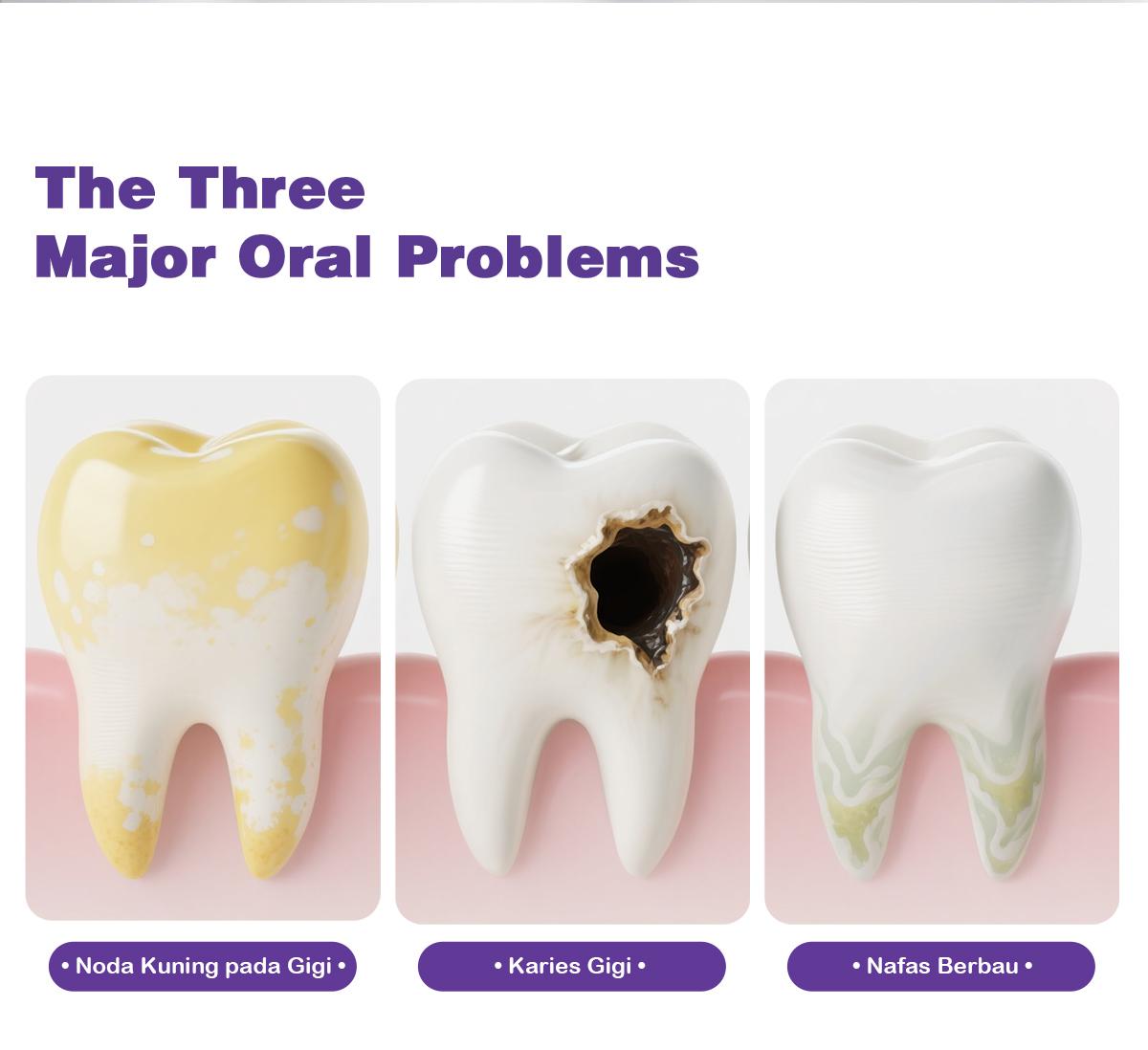 Dr.Ritta Pasta Gigi Pemutih SP68 100g, 20 Kali Lipat Gigi Putih, Bebas Noda Kuning, Napas Segar, Gigi Sensitif, Hidroksiapatit, Tetrasodium Pyrofosfat, Zink Sitrat