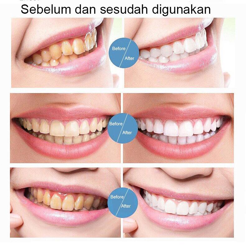 Pasta Gigi Pemutih SP-7 Probiotik 120g Menghilangkan Noda Karang Gigi Segar Aman untuk Siswa Dewasa dan Anak-anak Mencerahkan Gigi dan Membantu Memperbaiki Bau Mulut