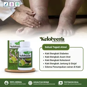 Keloreena - Obat Kaki Bengkak Diabetes, Kaki Bengkak Asam Urat, Kaki Bengkak Kolesterol, Kaki Bengkak Ginjal, Kaki Bengkak Jantung, Kaki Bengkak Edema Penumpukan Cairan di Kaki