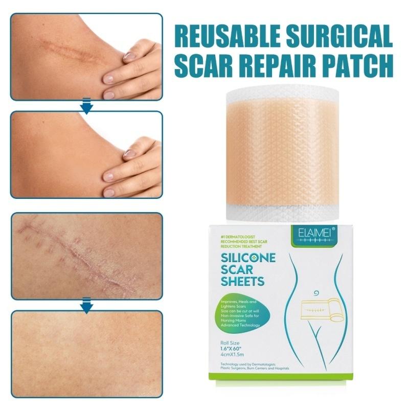 ⭐️ORI⭐️ELAIMEI Silicone Scar Sheets Patch Penghilang Keloid Tambalan Stretch Mark Surgery Scar Removal Silicone Repair Tape 4cm x 1.5m - Ready 3