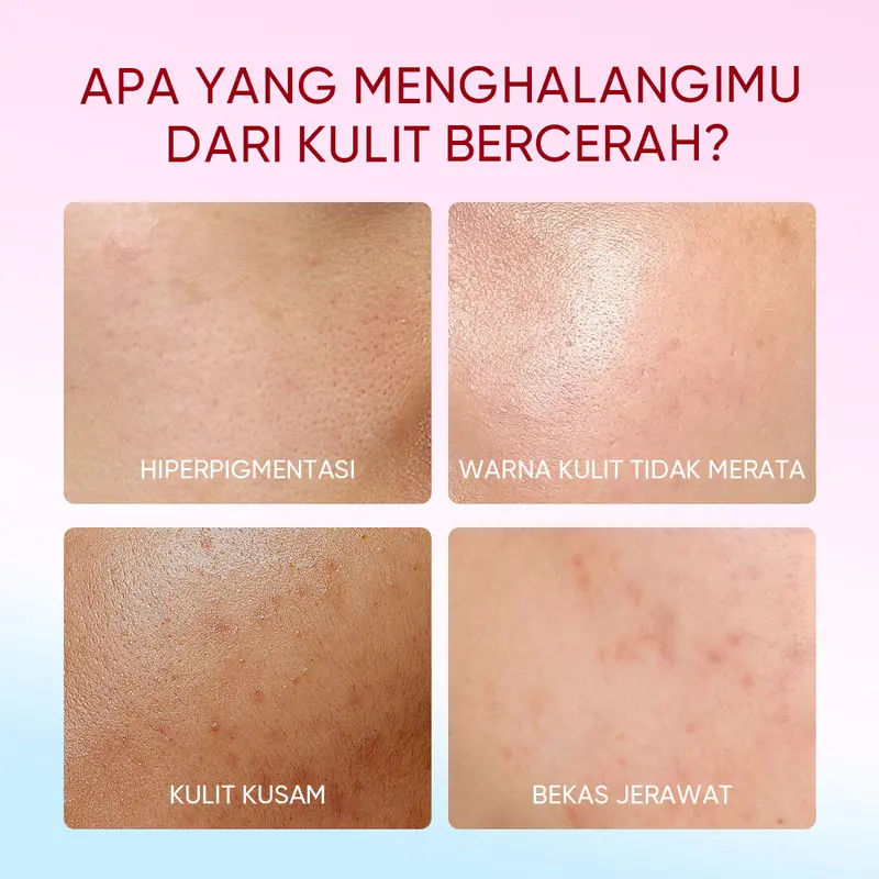 The Originote Brightening Moisturizer - Pelembab dan Mencerahkan Wajah Mengencangkan Muka Pencerah Vitamin Glowing  niacinamide acid skincare dull skin acne jerawat barrier Memutihkan Menerangi kulit kusam smooth Facial day night cream skincare routine 3