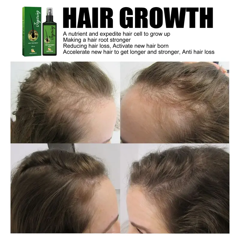 jaysuing ginger hair growth spray penumbuh rambut cepat serum penumbuh rambut botak hair tonic rambut rontok 30ml Kering Perawatan 4
