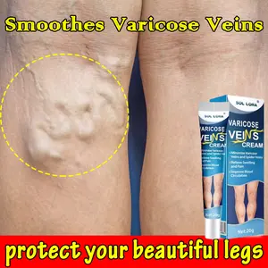 Varicose Veins Cream Obat Varises Salep Penghilang Varises Vaskulitis /Ampuh Tanpa Operasi / Obat Salep Varises Yg Asli Cream
