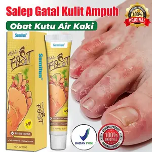 Obat Kutu Air Kaki 20g Gatal Kutu Air & Bau Kaki HILANG BEGINI! Obat Jamur, Kurap & Bau Kaki. 99% BACTERI DIES!