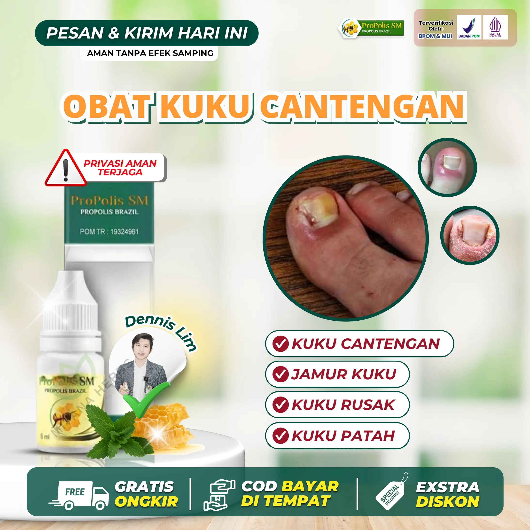 Propolis SM Obat Cantengan Kuku Berjamur dan Rusak Kutu Air Kaki  Jamur Kuku Bau Kuku Patah Kuku Bernanah Tetes Cantengan Isi 6 ml