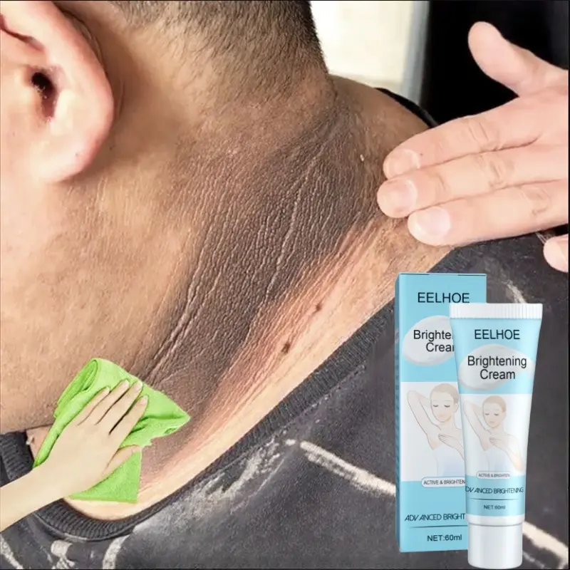 Whitening Cream Krim Pemutih Armpit whitening Brightening pemutih ketiak