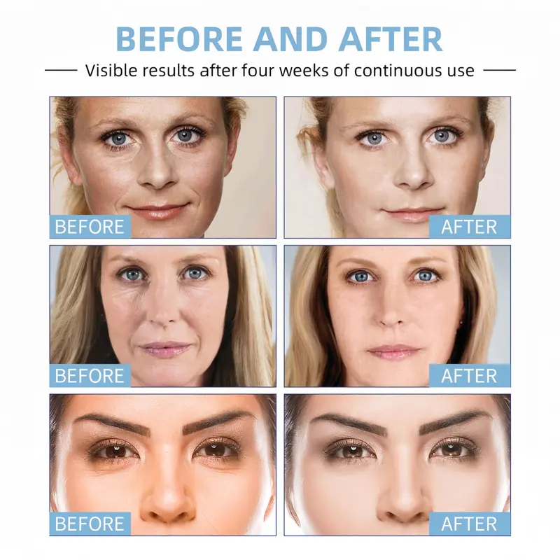 EELHOE Botox Stock Solution Facial Serum, Botox Stock Anti-Aging Serum, Promotes Skin Collagen, Reduces Fine Lines, Wrinkles, Plumps Skin 3