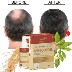 MINOXIDIL5%penumbuh rambut & brewok with Ginseng extract for MEN made in USA - RAYGOLD -  MINOX MINOKSIDIL anti rontok & kebotakan SERUM RAMBUT HAIR TONIC HAIRTONIC HAIRTONIK KIRKLAND BOURN HIMS ROEGAN ROGAINE