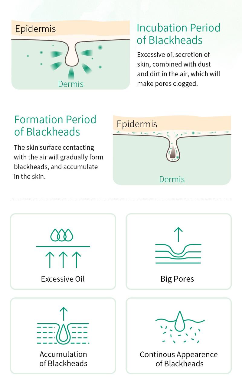 Product Introduction of BREYLEE Tea Tree Oil Blackhead Mask Pore Refining Serum Facial Blackhead Treatment 17ml Skincare Comfort 3
